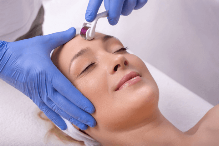How Does Collagen Induction Therapy Work