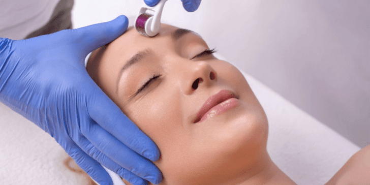 How Does Collagen Induction Therapy Work