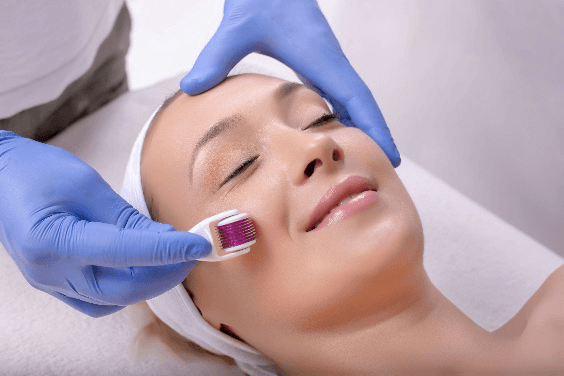 What is Collagen Induction Therapy