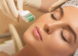 Micro Needling Eerie Treatment and The Benefits You Can Get From It