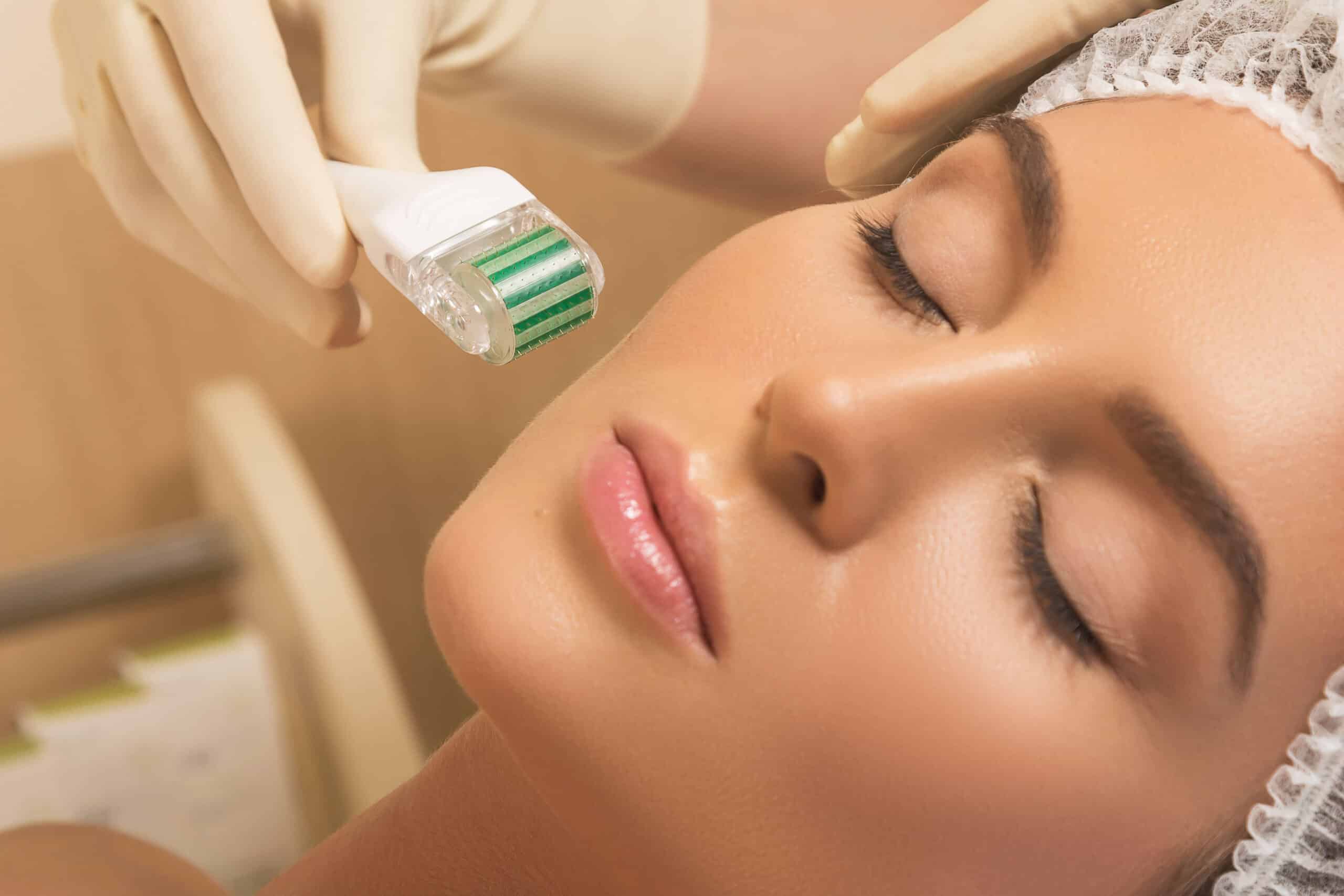 Micro Needling Eerie Treatment and The Benefits You Can Get From It