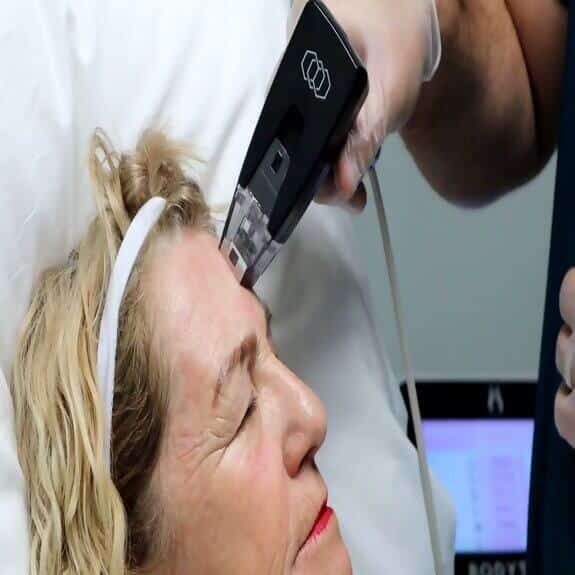 Collagen Induction Therapy St. Suite 3100 Erie PA 16509 glowlaserbeauty