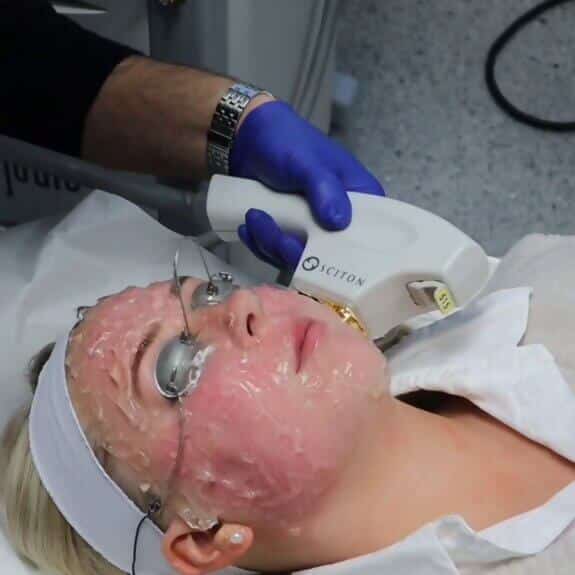 Forever Young BBL St. Suite 3100 Erie PA 16509 glowlaserbeauty