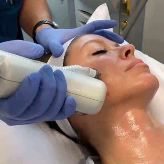 HALO Hybrid Fractional Laser St. Suite 3100 Erie PA 16509 glowlaserbeauty