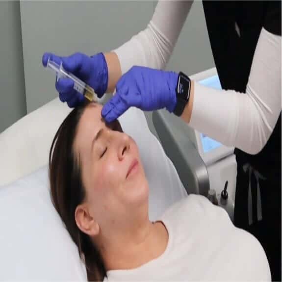 Vampire Facelift Procedure St. Suite 3100 Erie PA 16509 glowlaserbeauty
