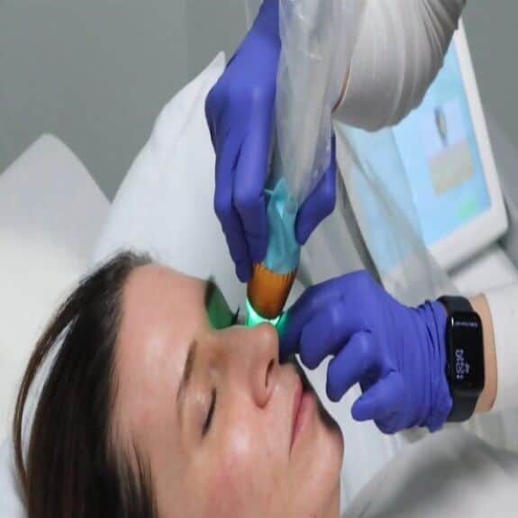 Vampire Facials St. Suite 3100 Erie PA 16509 glowlaserbeauty