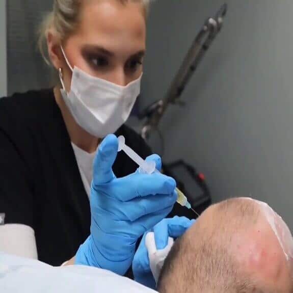 Vampire Hair Restoration In Erie PA Glow Laser Beauty