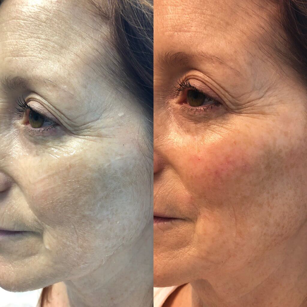 Gallery Glow Laser and Beauty Center in Erie, PA