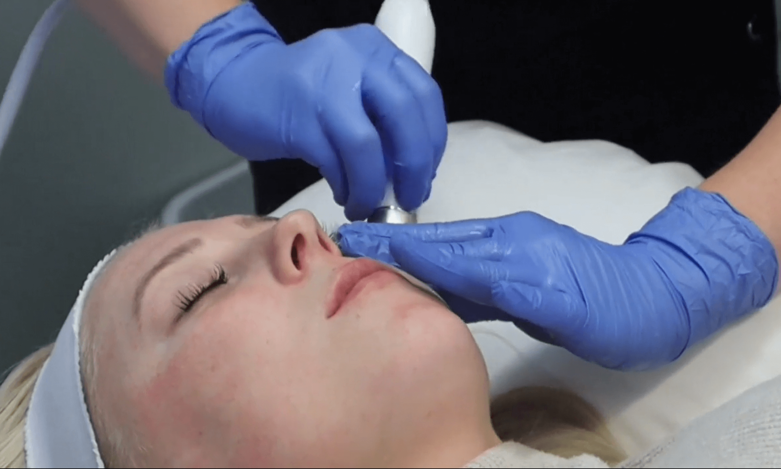 Aquaglow Facial Benefits in Erie PA | Glow Laser Beauty