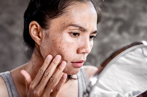 sad Asian woman having skin problem checking her face with dark