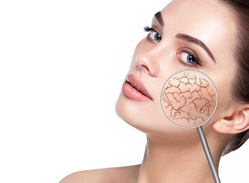 Female face showing dry facial skin using magnify glass. Cracked dry skin